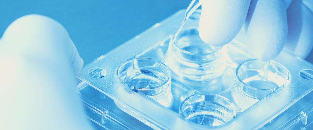 selecao de embrioes
