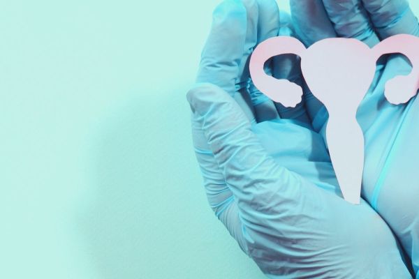Cirurgia de Cisto no Ovário 
