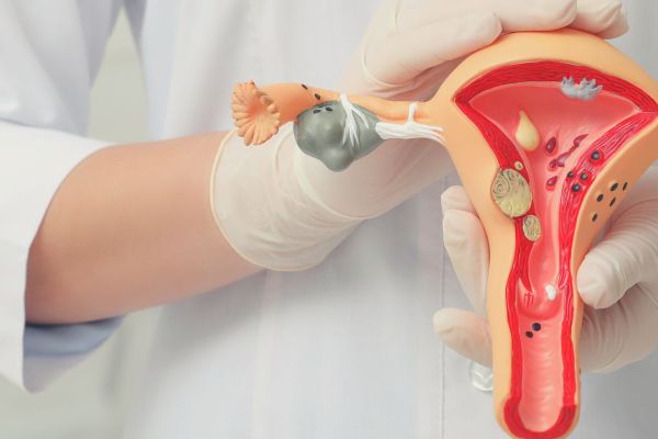 histeroscopia com biopsia
