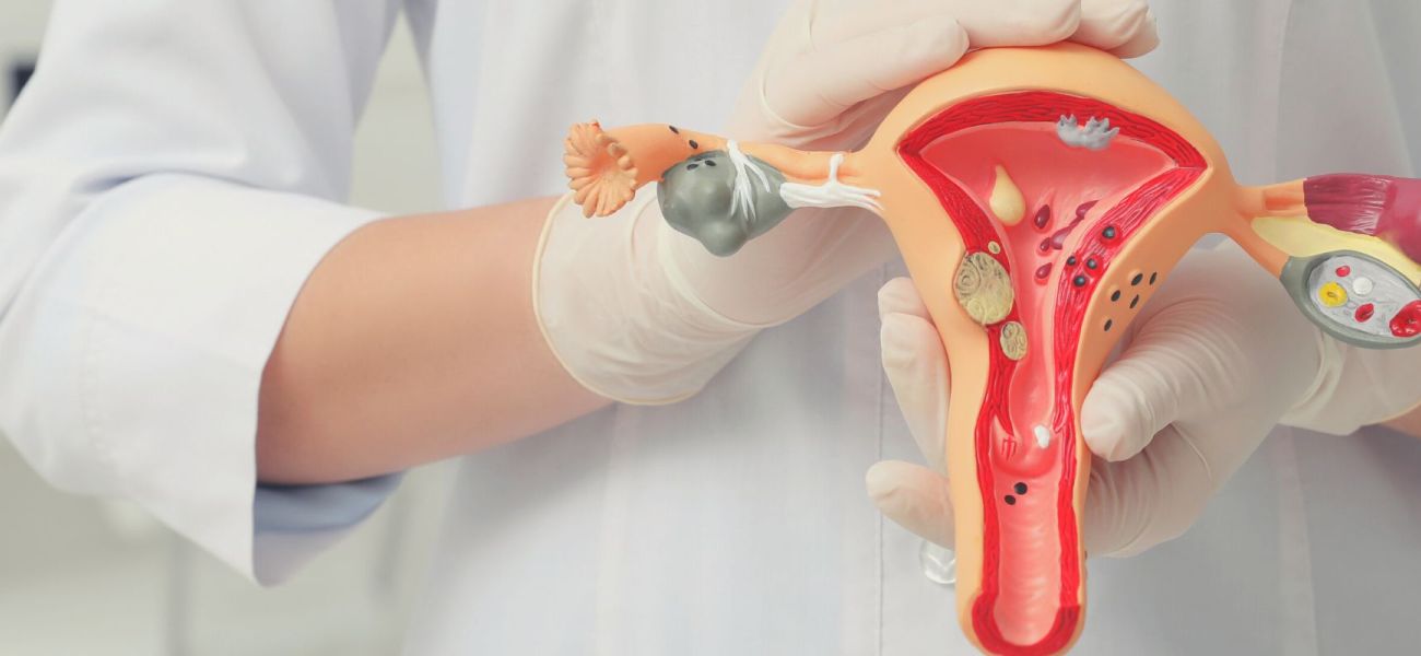 histeroscopia com biopsia